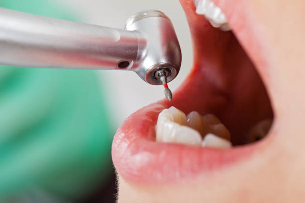 Best Emergency Root Canal Treatment in Old Tappan, NJ